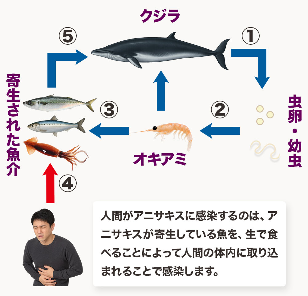 アニサキスの寄生場所と生態について